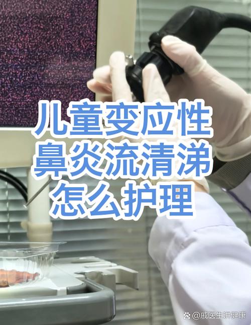 變應(yīng)性鼻炎流清涕的鼻腔清潔護(hù)理指南